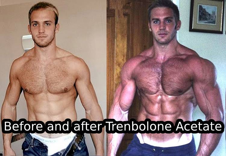 Before and after Trenbolone Acetate