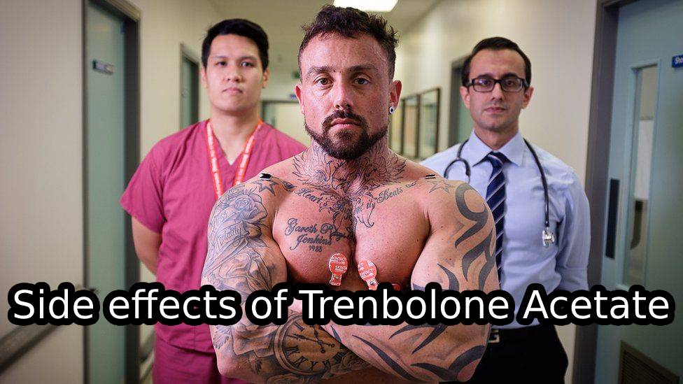 Side effects of Trenbolone Acetate